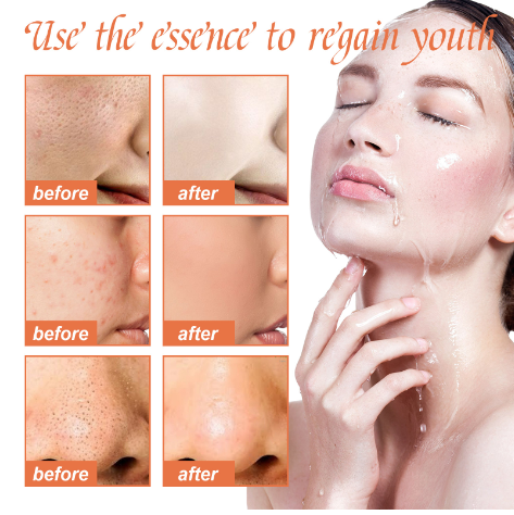 OUHOE Serum Collagen Peptides